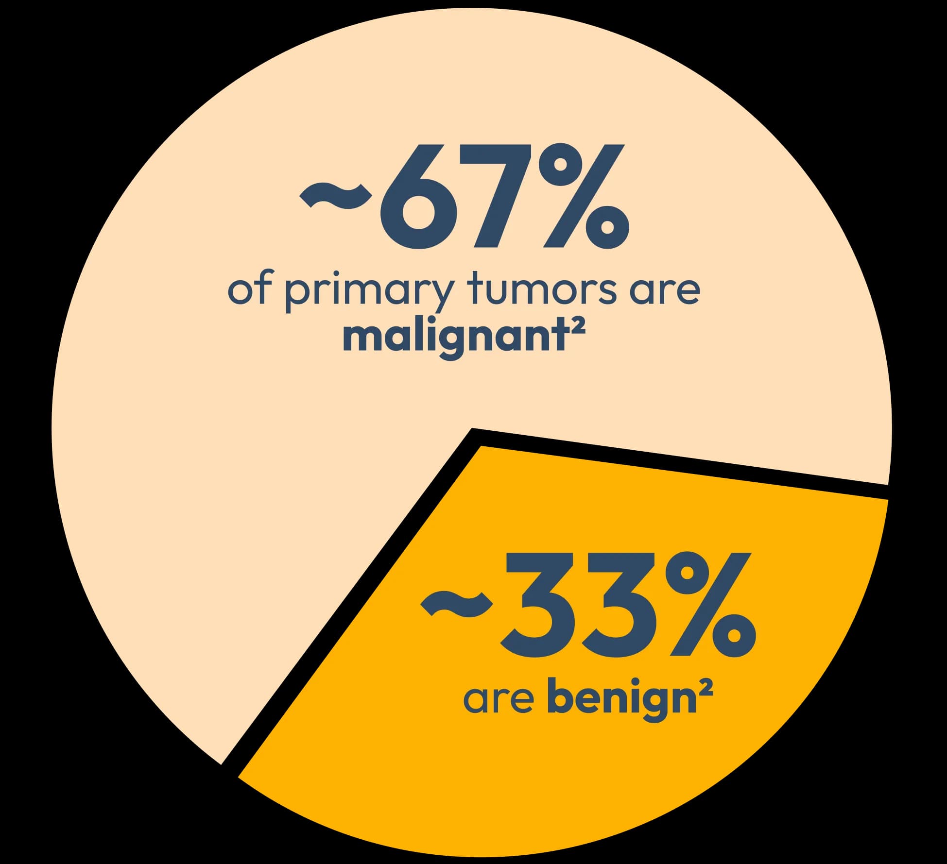 Pie chart showing 67% of primary tumors are malignant and 33% are benign