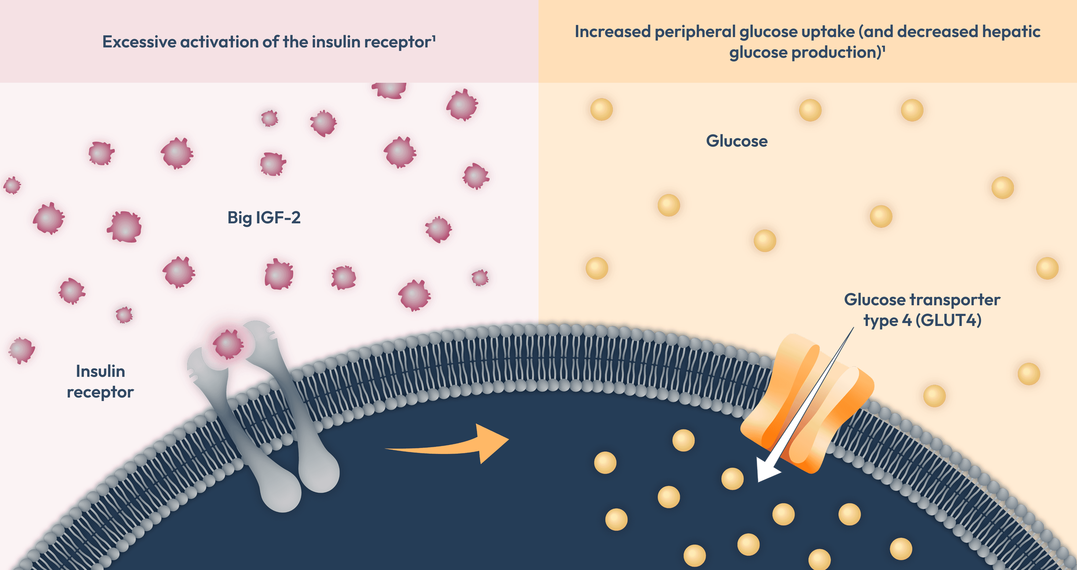 Diagram showing excessive activation of the insulin receptor by big IGF-2 and increased peripheral glucose uptake with decreased hepatic glucose production