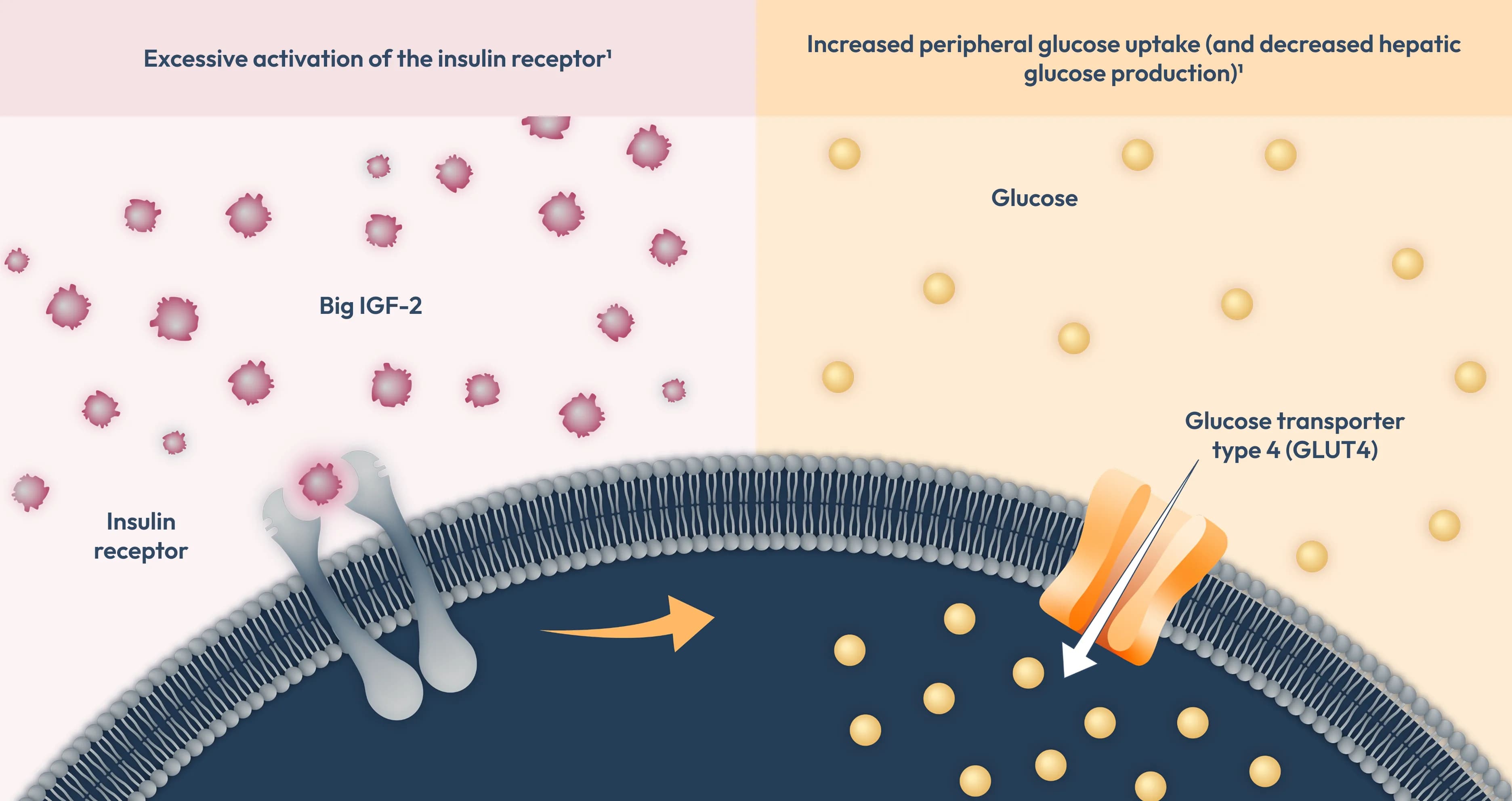 Diagram showing excessive activation of the insulin receptor by big IGF-2 and increased peripheral glucose uptake with decreased hepatic glucose production