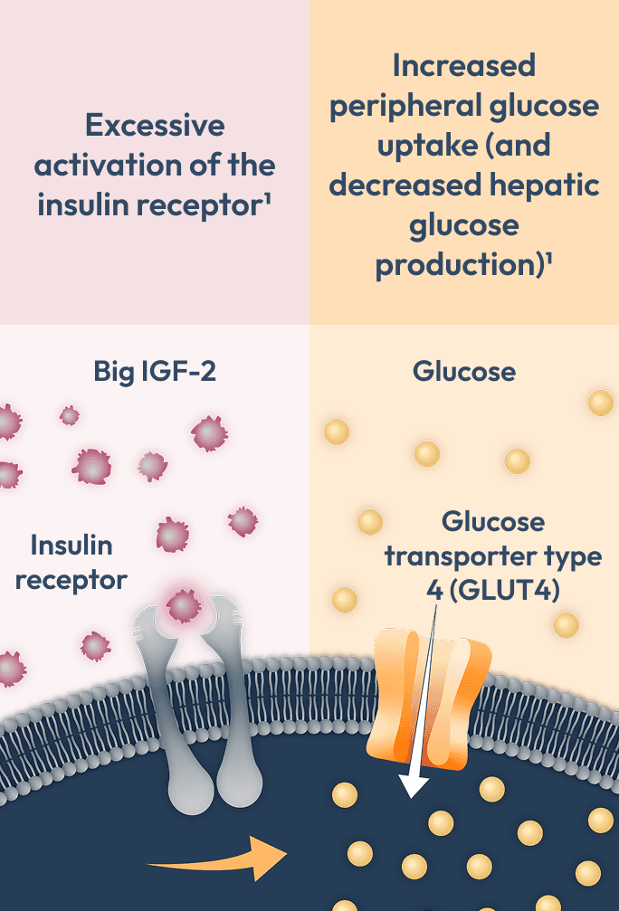Diagram showing excessive activation of the insulin receptor by big IGF-2 and increased peripheral glucose uptake with decreased hepatic glucose production