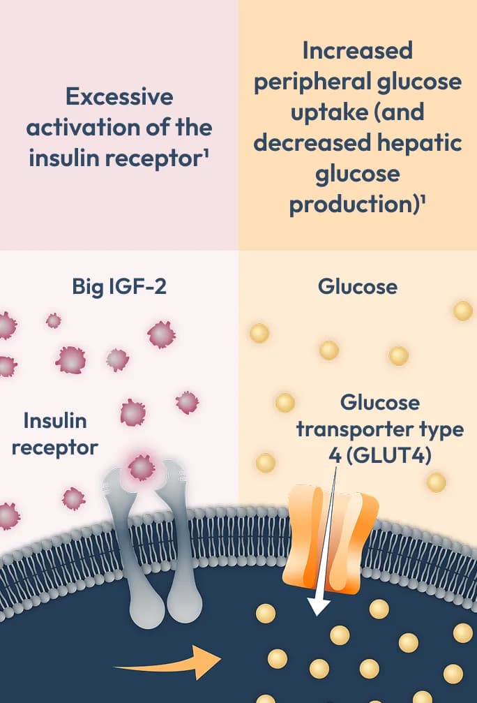 Diagram showing excessive activation of the insulin receptor by big IGF-2 and increased peripheral glucose uptake with decreased hepatic glucose production