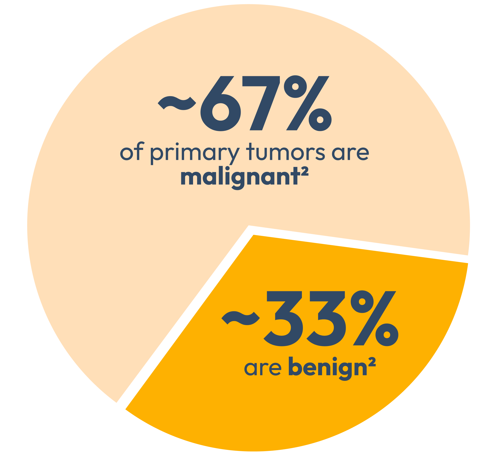 Pie chart showing 67% of primary tumors are malignant and 33% are benign